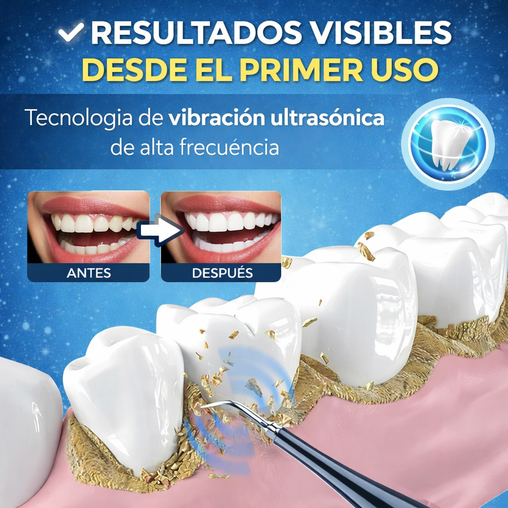 🔥40% OFF 🔥 SET LIMPIADOR DENTAL 🦷 Remueve sarro y elimina suciedad desde casa.