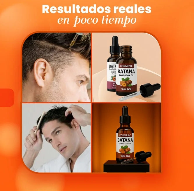 2x1 ACEITE DE BATANA - Hidratación y Fortalecimiento Capilar- 30ML