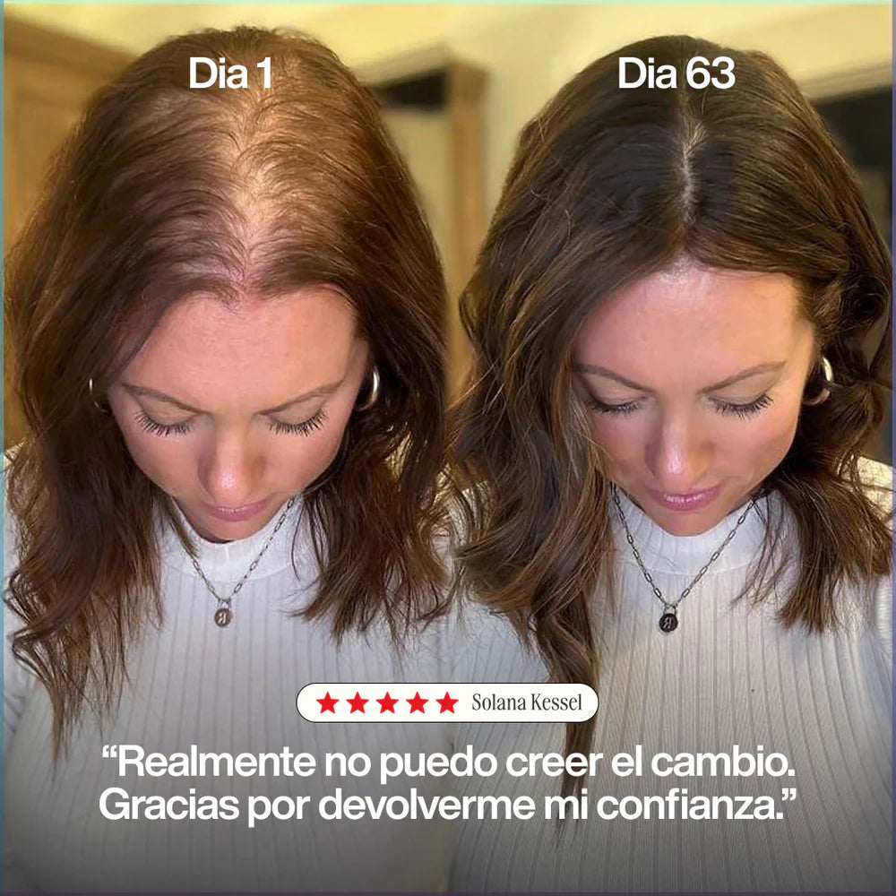 🚨 TRATAMIENTO CAPILAR ANTI-CAIDA ¡CEPILLO CON LUZ LED Y MASAJEADOR+ ACEITE DE BATANA GRATIS! 🎁